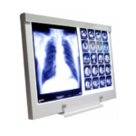 Negatoskop LED NGP 21